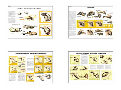 �.���������� ������ ������� ��� �������������� ������ (4 ��,�����,70*100)